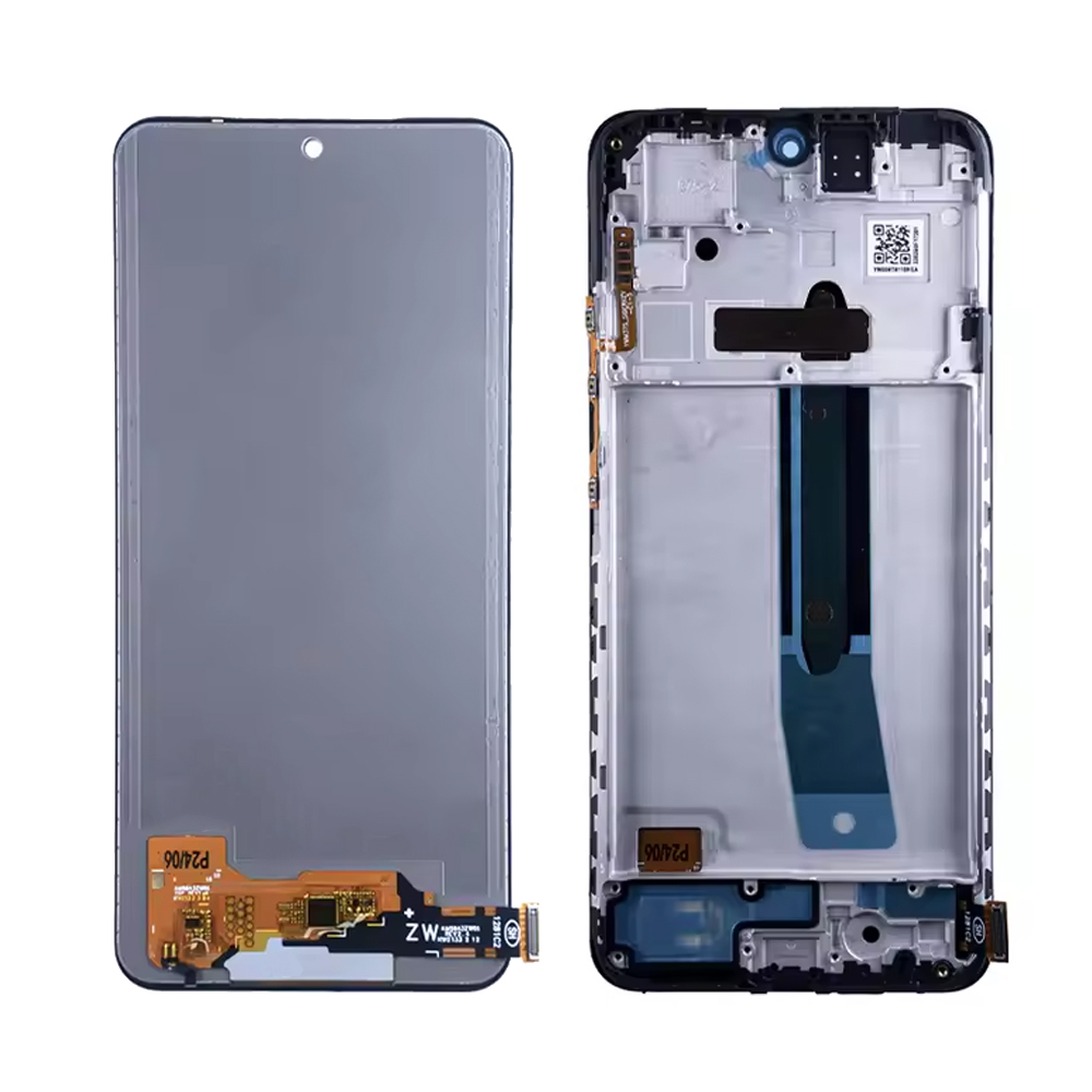 Redmi Note 11 Screen