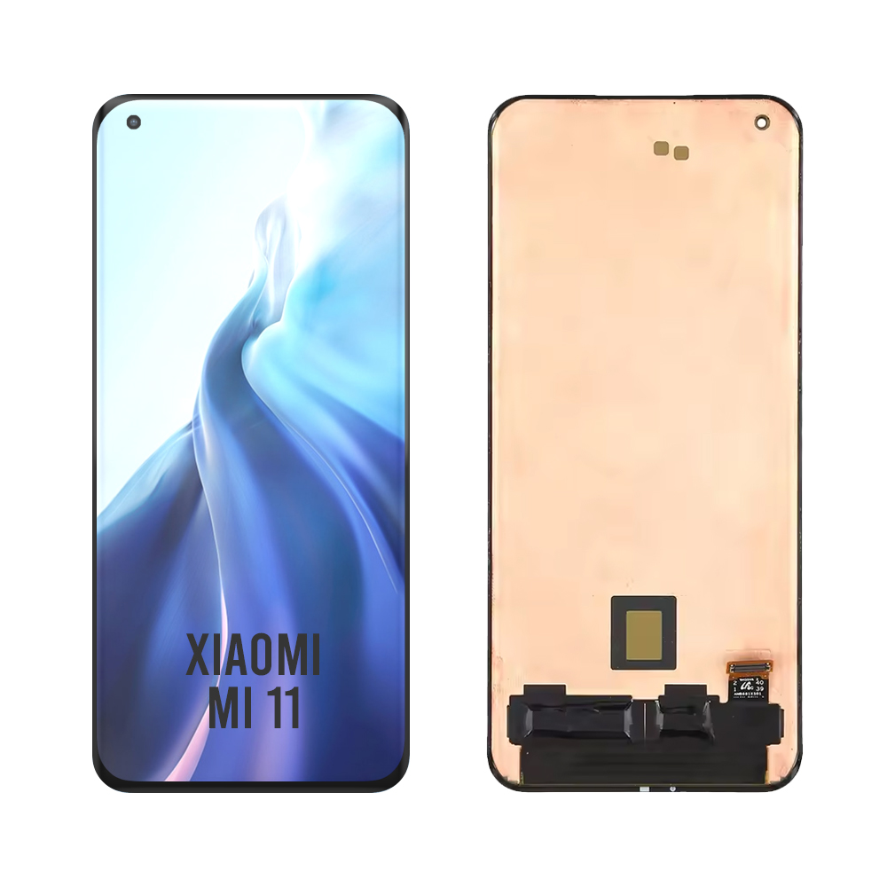 Xiaomi Mi 11 Screen